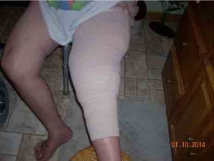 sunglitzcompressionwrapoverfoambandage-cropped